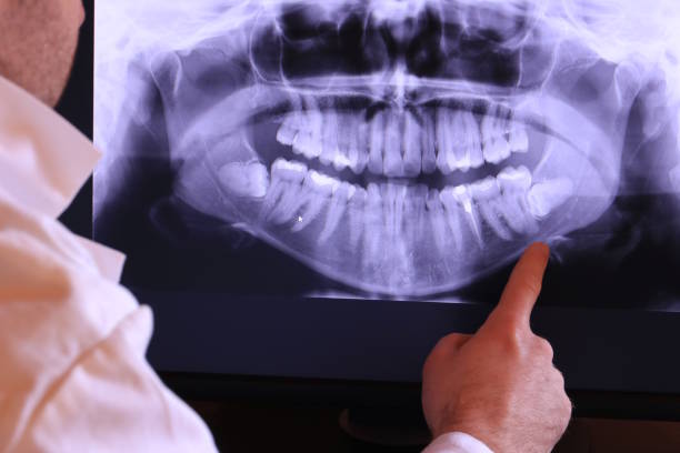 Emergency Dentist Open Today in OH