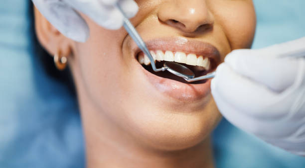 Best Cracked Tooth Emergency Dentist  in Silver Lake, OH
